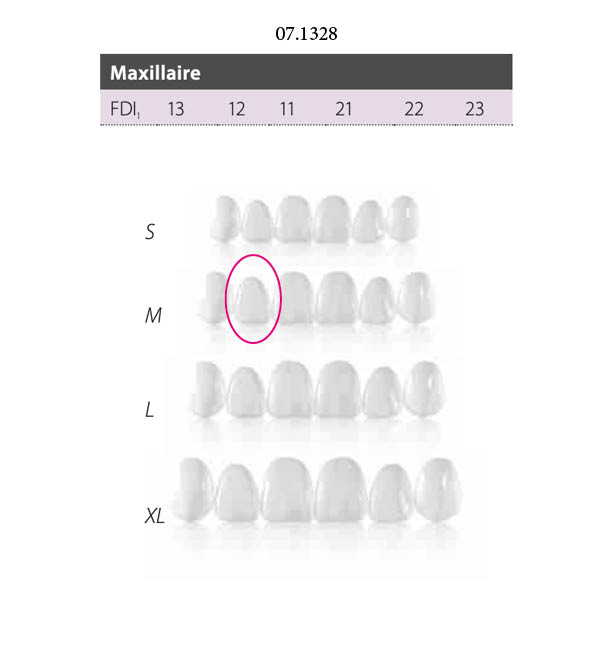 FACETTES COMPONEER UPPER M ENAMEL W OPAL 12