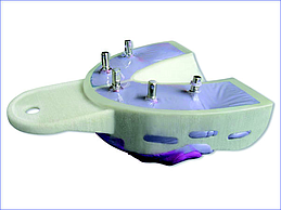 MIRATRAY IMPLANT SMALL UNTER 6 ST