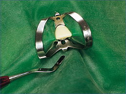 FIT KOFFERDAM REF.355335
